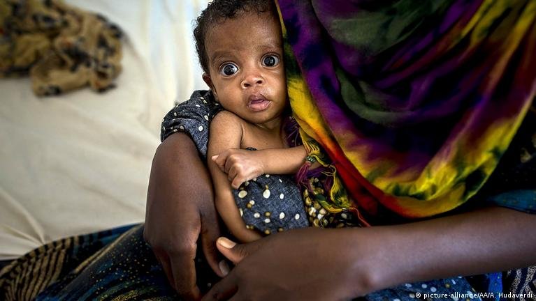 UNICEF, insani yardımların kesildiği Somali’de en büyük bedeli çocukların ödediğini bildirdi UNICEF, insani yardımların kesildiği Somali'de en büyük bedeli çocukların ödediğini bildirdi