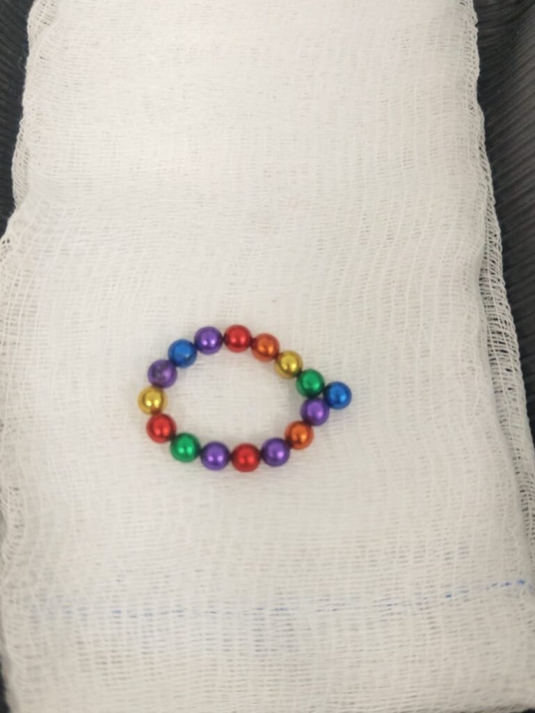 Kocaeli’de 3 yaşındaki çocuğun midesinden ve boğazından 21 parça mıknatıslı top çıkarıldı Kocaeli'de 3 yaşındaki çocuğun midesinden ve boğazından 21 parça mıknatıslı top çıkarıldı